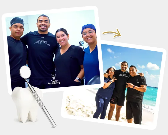 patient of cancun dental design ponting at his perfect smile with veneers