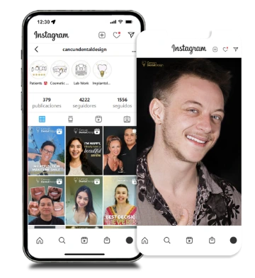 cost of full-moth dental implants in Mexico