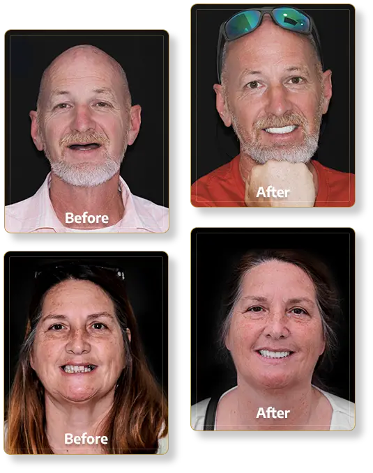 patients at cancun dental design restorative dental work