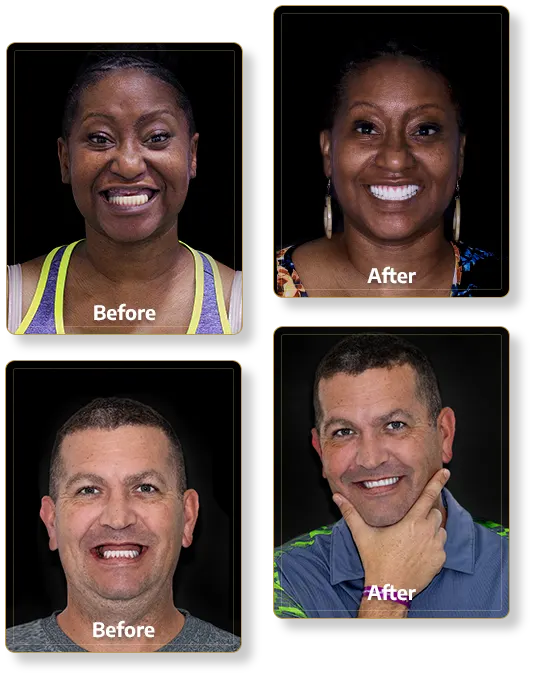 patients at cancun dental design restorative dental work