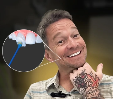 patient with a laser teeth whitening treatment