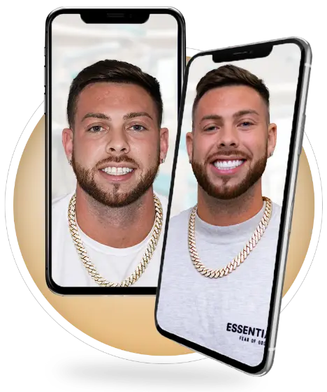 man patient ith 2500 veneers in cancun