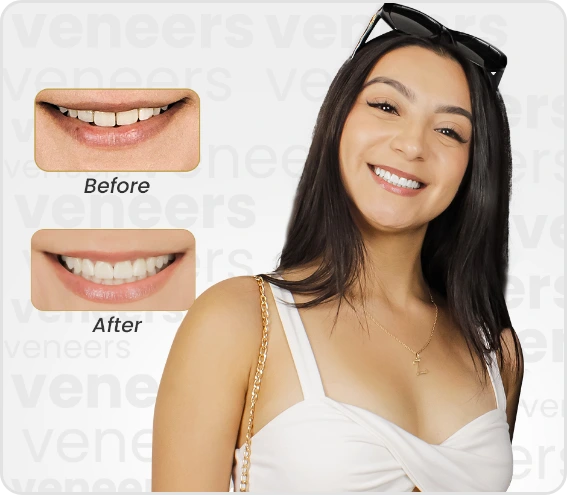 Dental Results, before and after in Cancun Dental Design