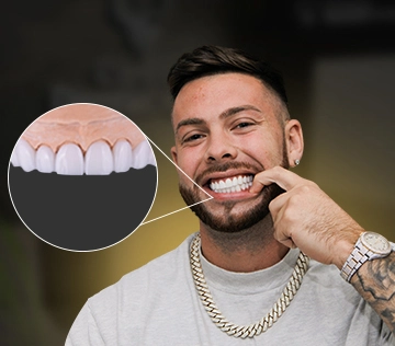 patient with a laser teeth whitening treatment