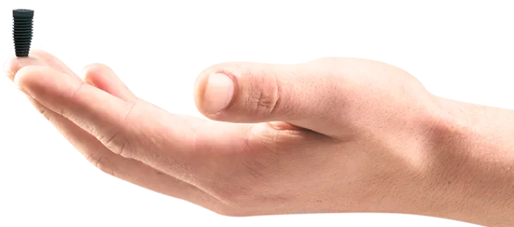 dental implants in Mexico