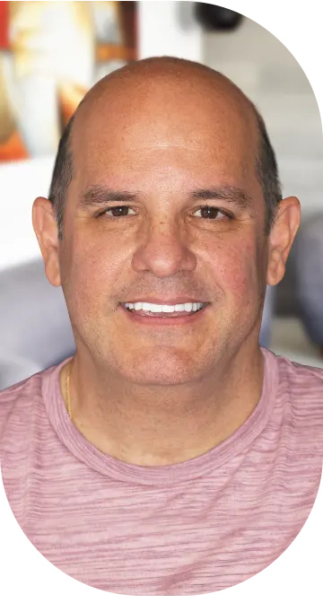 3 on 6 implants cost mexico