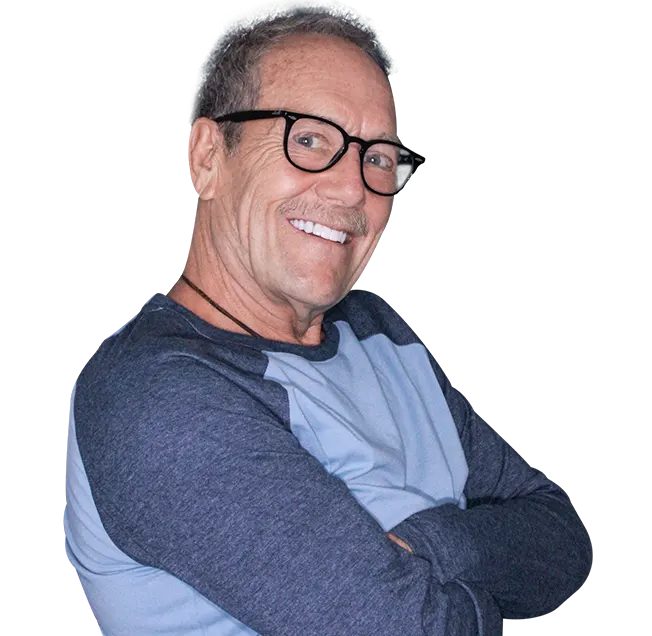 Adult patient with 3 on 6 dental implants in Mexico