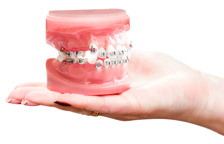 mini dental iImplants vs traditional dental implants