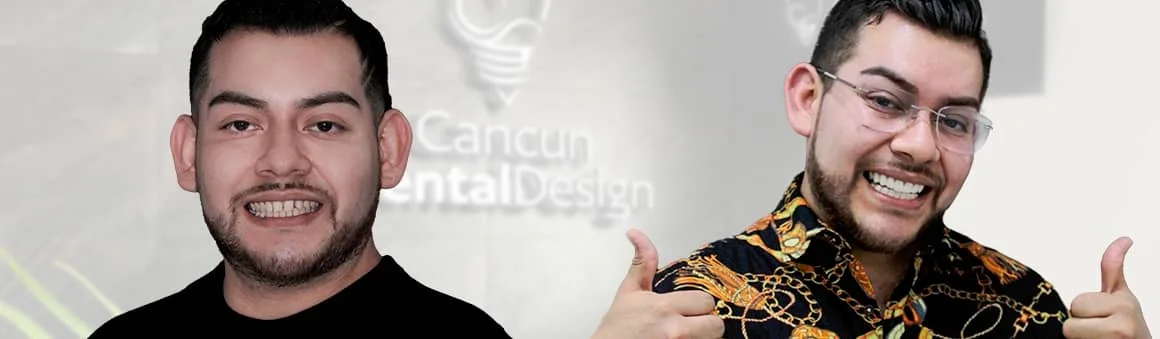 the benefits of getting crowns in mexico