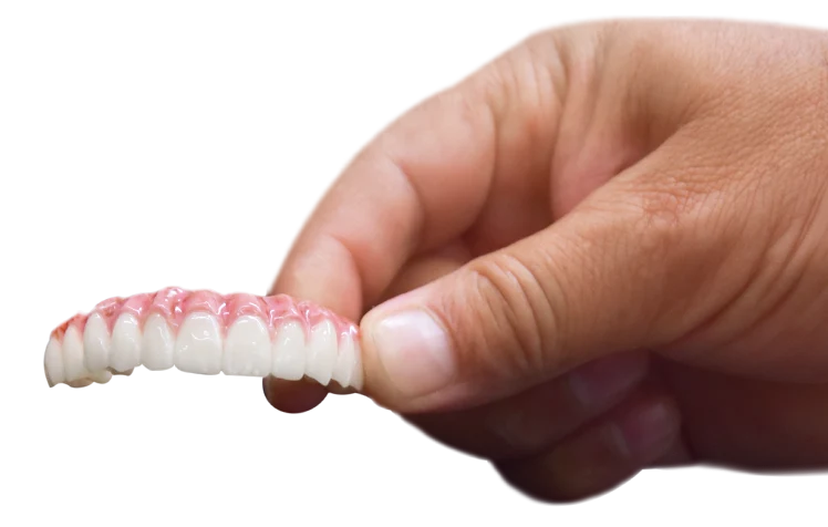 palateless snap-on denture in mexico