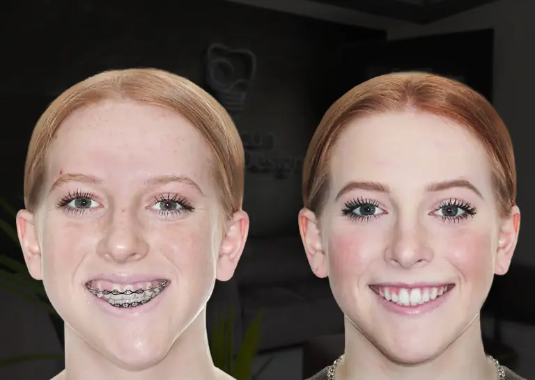 root canal therapy banner patient