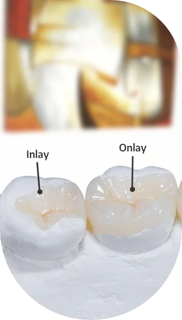 How do dental crowns are made