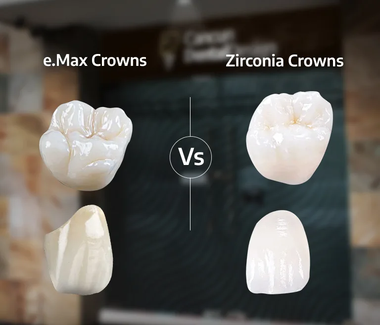 emax crowns vs zirconia crowns