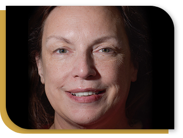 Before and after Snap On Denture