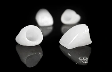 example of dental crowns used in a full smile makeover in Mexico