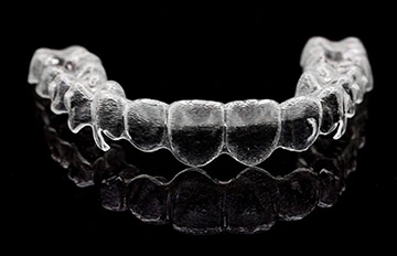 example of invisalign braces used in a full smile makeover in Mexico