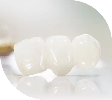 emax dental crowns before and after photos