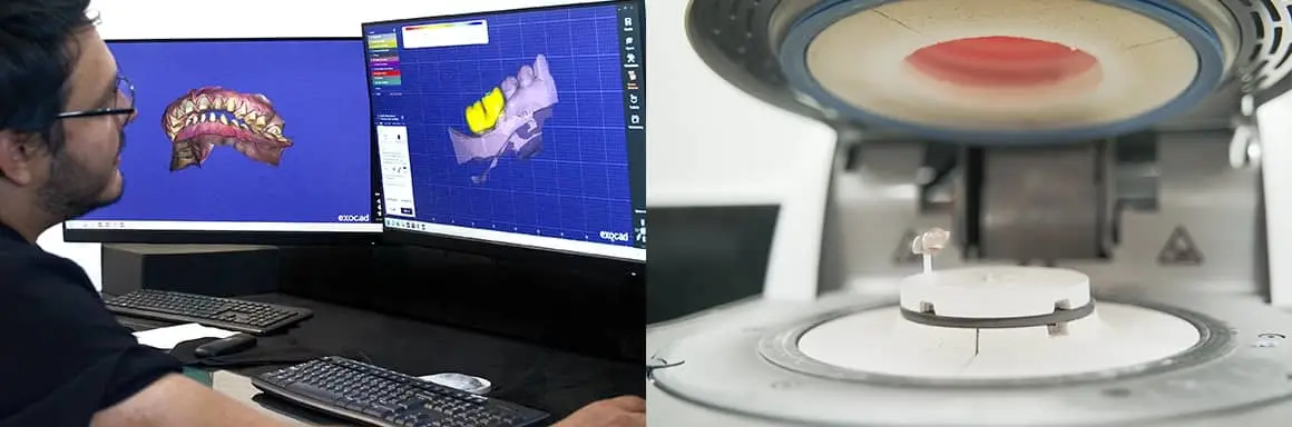 How do dental crowns are made