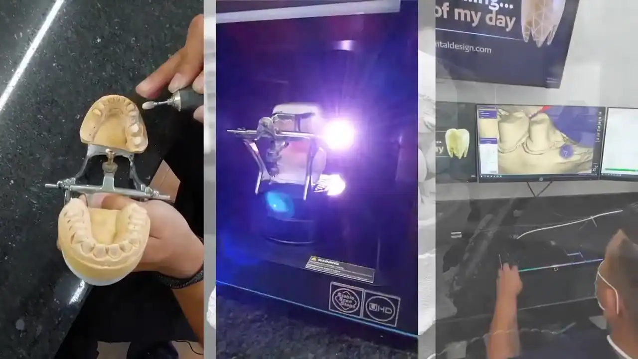 smiling for his dental work in cancun