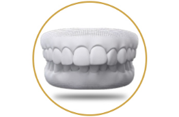 Overbite maloclussion for orthognathic surgery