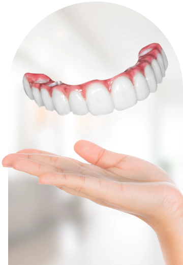 switch snap-on-denture to an all-on 4