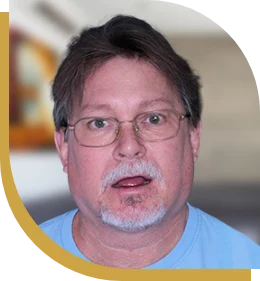 patient of cancun dental design ponting at his perfect smile with veneers