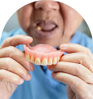 Before and after Snap On Denture