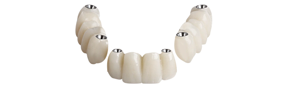 3 On 6 Denture treatment