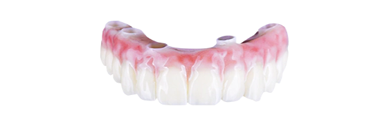 snap on dentures treatment
