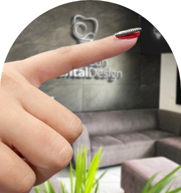 mini implants in mexico