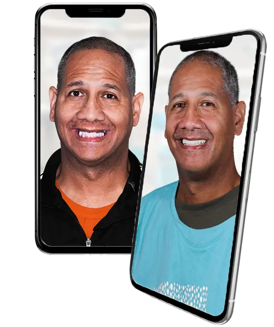 patient with a snap-in dentures in mexico