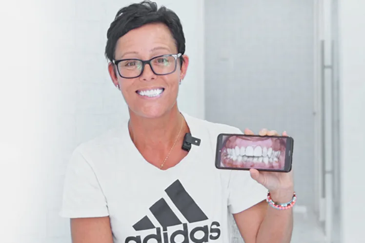 adult patient at cancun dental design looking at his final restoration with dental crowns.