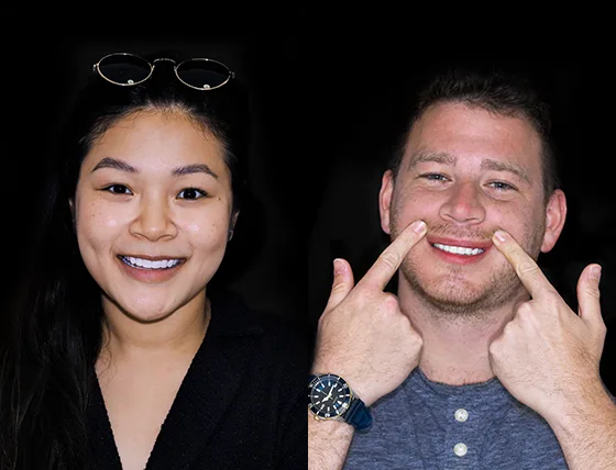 cancun dental design patients smile makeover before and after pictures