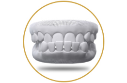 Underbite maloclussion for orthognathic surgery