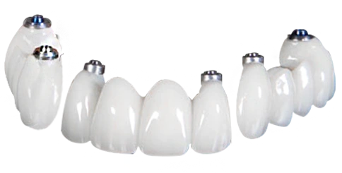 dental implant brands used in cancun mexico