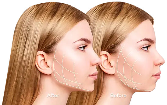 snap-on dentures cost mexico results