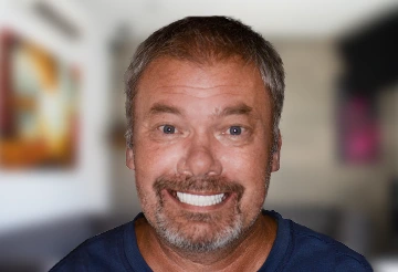 X ray of a patient implant fixed denture